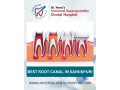 expert-root-canal-treatment-at-universal-dental-hospital-save-your-natural-tooth-small-0