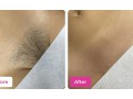 get-salon-smooth-results-with-the-best-bikini-hair-removal-wax-small-0