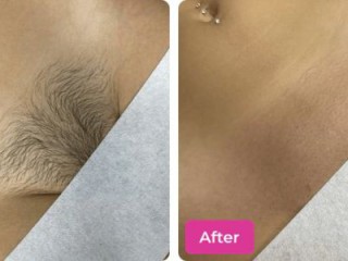 get-salon-smooth-results-with-the-best-bikini-hair-removal-wax