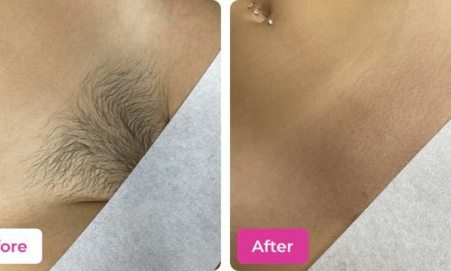 get-salon-smooth-results-with-the-best-bikini-hair-removal-wax-big-0