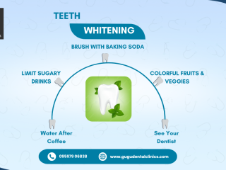 teeth-whitening-tips-gugu-dental-clinic-coimbatore