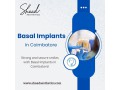basal-implants-in-coimbatore-shaadaesthetics-small-0