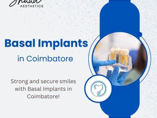 basal-implants-in-coimbatore-shaadaesthetics